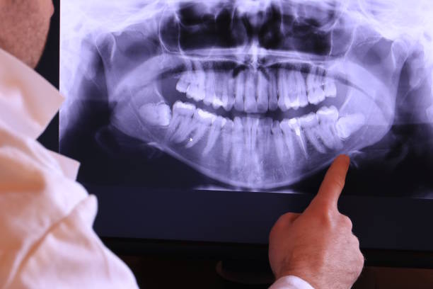 Best Emergency Tooth Extraction in Glastonbury Center, CT