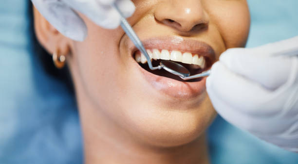 Best Emergency Wisdom Teeth Removal in Glastonbury Center, CT